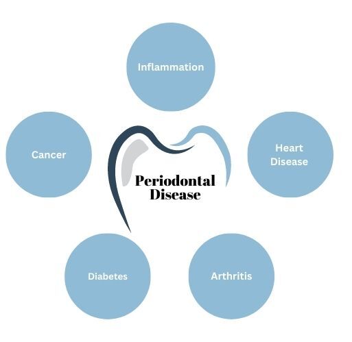 Periodontal Disease related issues (Inflammation, Heart Disease, Arthritis, Diabetes, Cancer)